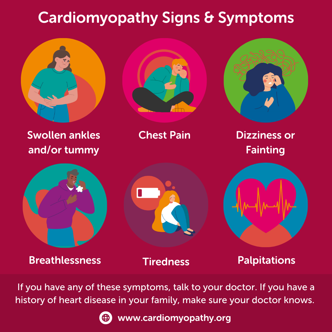 Dilated 2025 cardiomyopathy symptoms